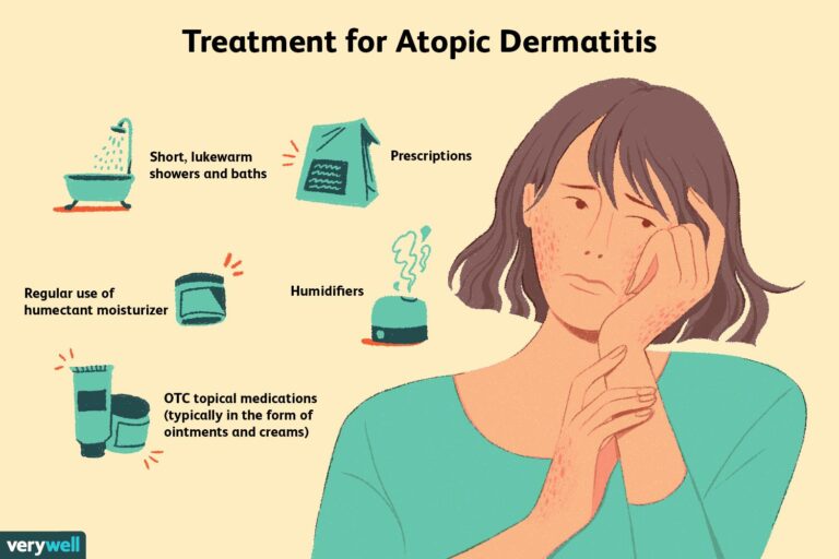 Atopic Eczema Home Treatment