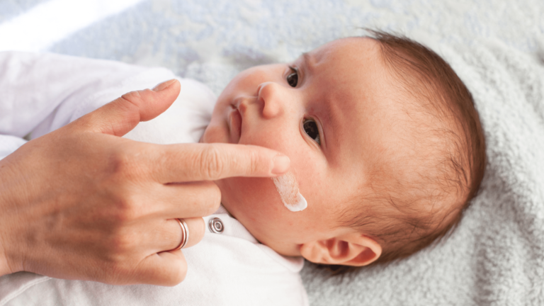 Atopic Eczema Newborn