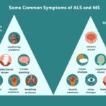 What is the Difference between Multiple Sclerosis And Multiple Dystrophy