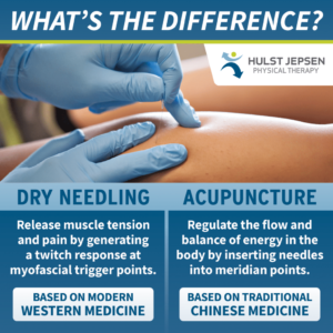 Dry Needling In Physical Therapy